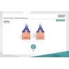 DIGITUS UTP LAN cable, patch 6 cat, 3.0m, mėlynas, 2xRJ45, DK-1617-030/B