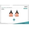 DIGITUS CAT 6 U/UTP pataisos laidas - LSZH