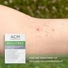Acm Molutrex tirpalas 3ml