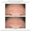 NeoStrata Resurface Minkštinantis Surface Skirtas kasdieniam naudojimui Peel