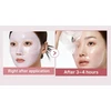 Medicube PDRN Rožinė Collagen Gel Mask gelio tekstūros drėkinamoji veido kaukė, 4 vnt.