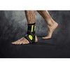 ČURNOS ĮTVARAS SELECT ANKLE Support 2-parts DYDIS XL