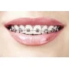 Atos SALVIA ORTHO DENTAL NAKTINĖ PASTA 75M