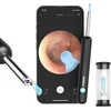 Smart Visual Ear-Clean strypas Bebird R1 juodas