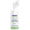 Diagnosis Novaclear spuogams skirtos valomosios veido putos 100 ml