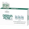 Activeshop Koncentratas Farmona Dermaacne+, 5X5 ml