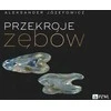 PZWL dantų skerspjūviai