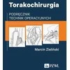 PZWL krūtinės ląstos chirurgija