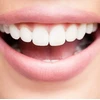 Vitis VITIS GINGIVAL Rinkinys PODRÓZNY