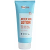 Derma - Losjonas po deginimosi saulėje 200 ml