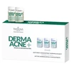 Activeshop Koncentratas Farmona Dermaacne+, 5X5 ml