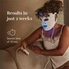 LED šviesos terapijos veido kaukė Silk'n Face Mask 100