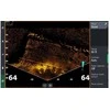 Lowrance ActiveTarget 2™ Live Sonaras pilnas komplektas