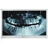 Neovo DR-24G DENTAL MONITORIUS