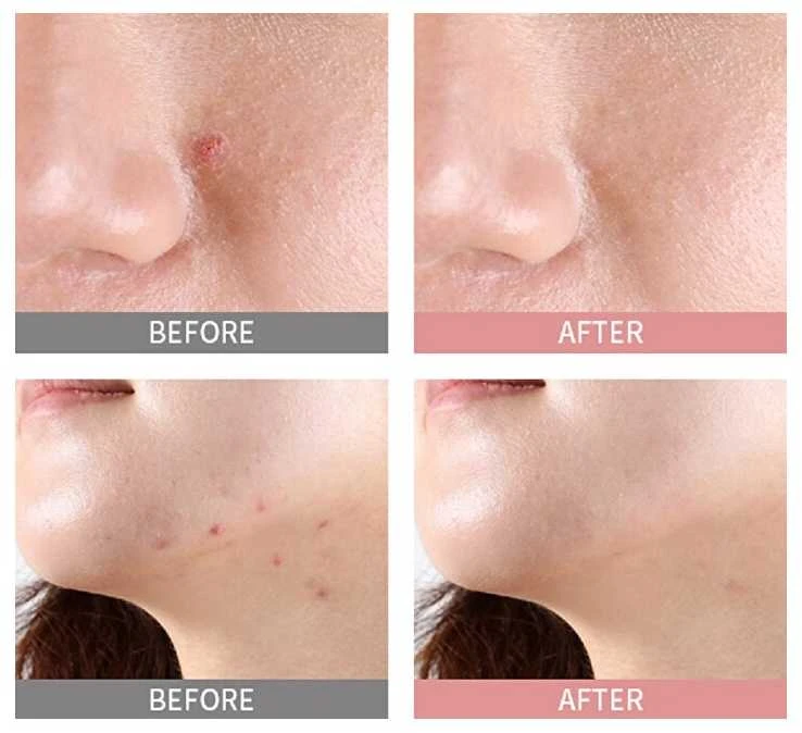 Naktinis serumas probleminei veido odai Mizon Goodbye Blemish Rožinė Spot Overnight, 19 ml