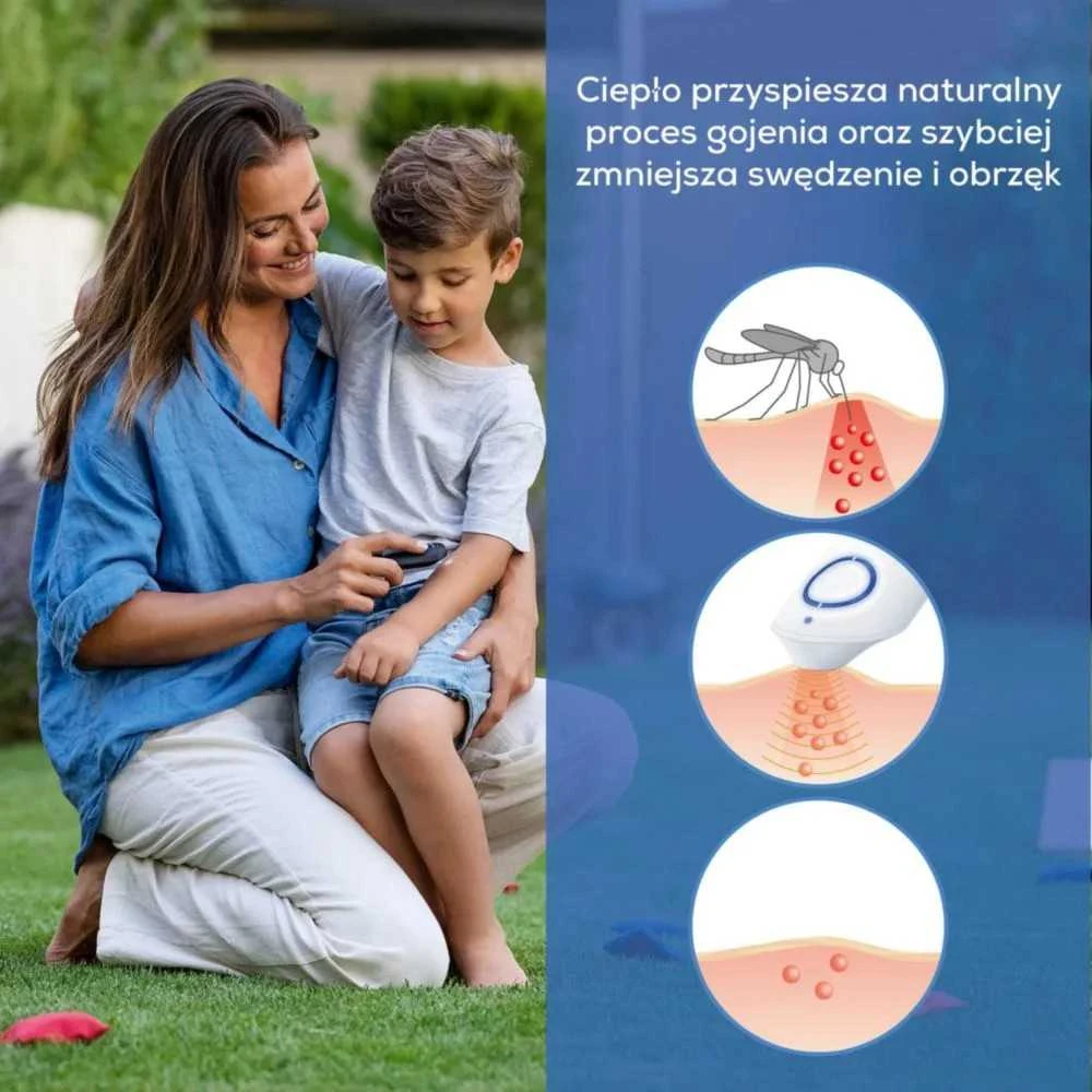 Beurer BR 90 vabzdžių įkandimų gydymo prietaisas – 5 metų garantija