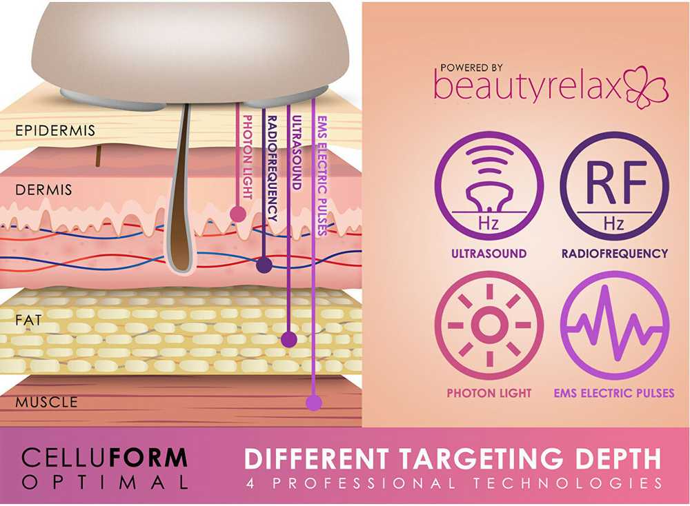 „BeautyRelax Beauty Relax Celluform Optimal“ estetinis prietaisas