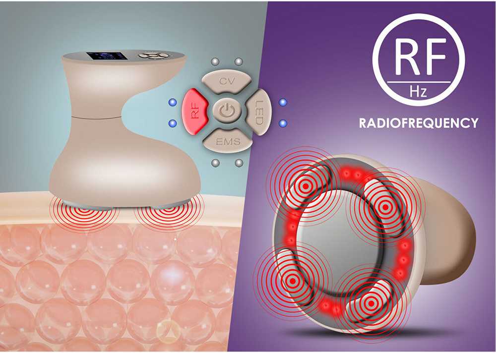 „BeautyRelax Beauty Relax Celluform Optimal“ estetinis prietaisas