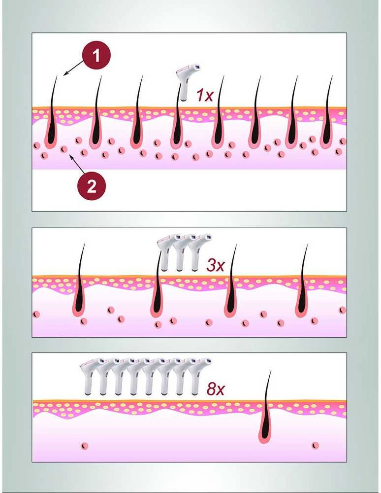 „BeautyRelax IPL Premium“ epiliatorius BR-1400