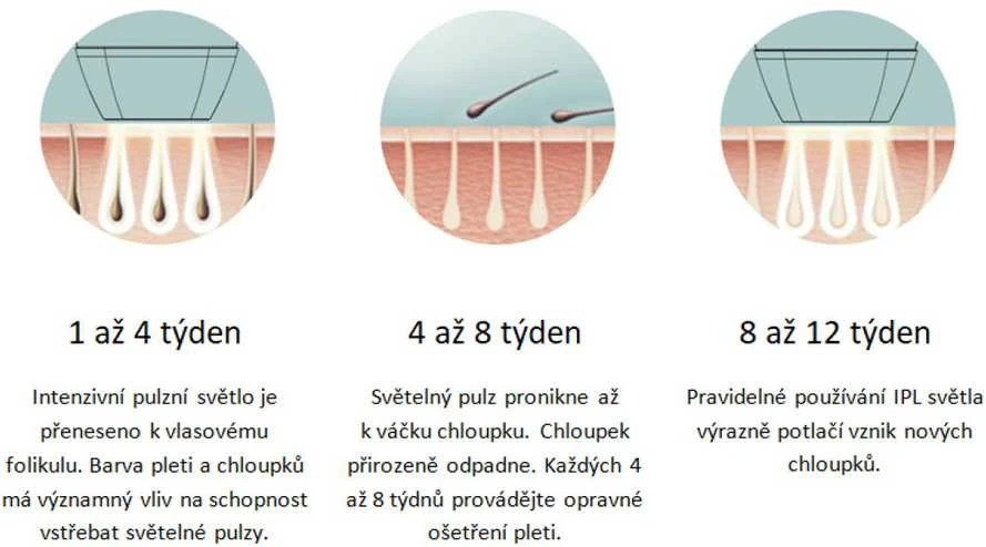 „BeautyRelax IPL“ išmanusis epiliatorius BR-1520