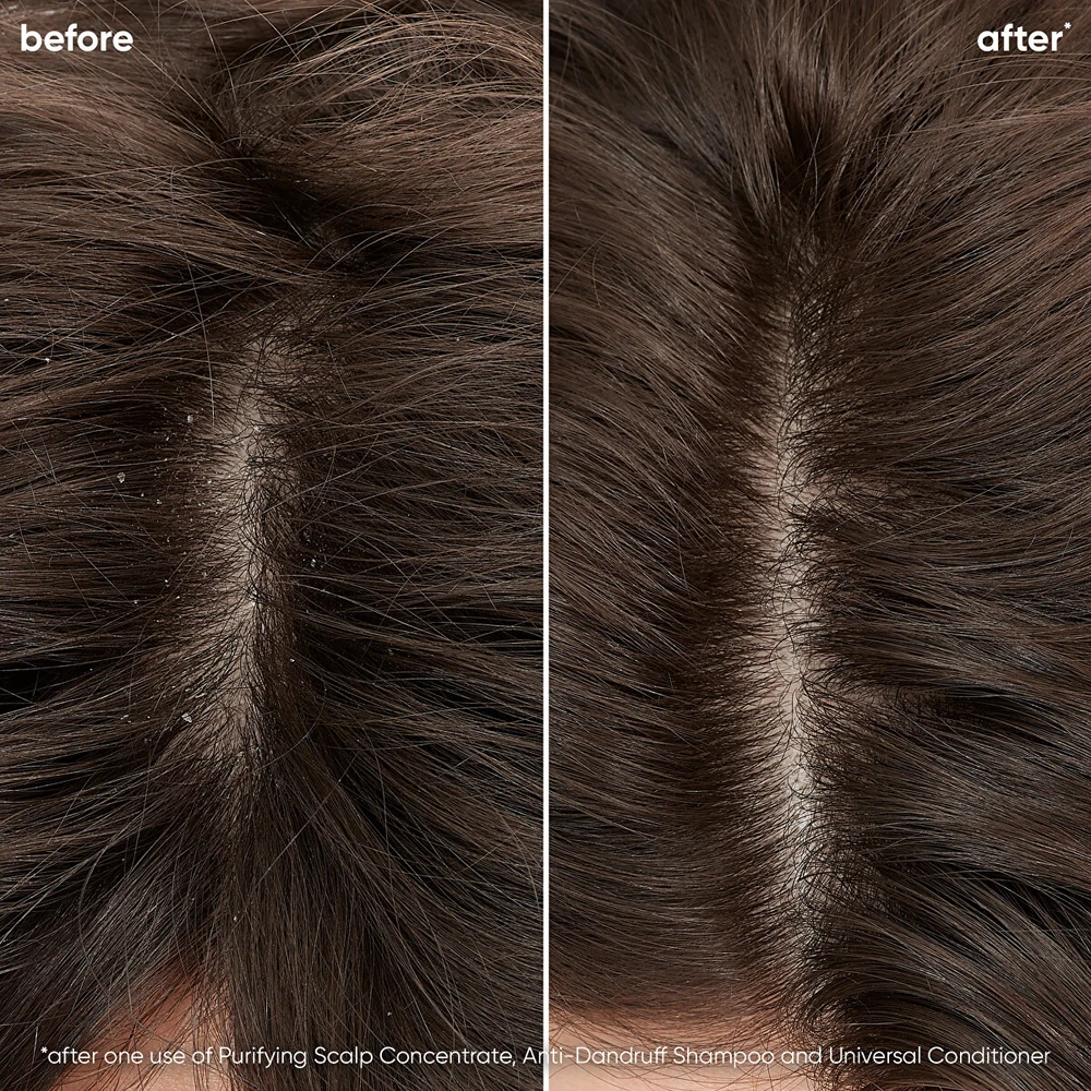 Biolage Universal kondicionierius visiems galvos odos tipams Scalp Sync (Universal Conditioner), 200 ml