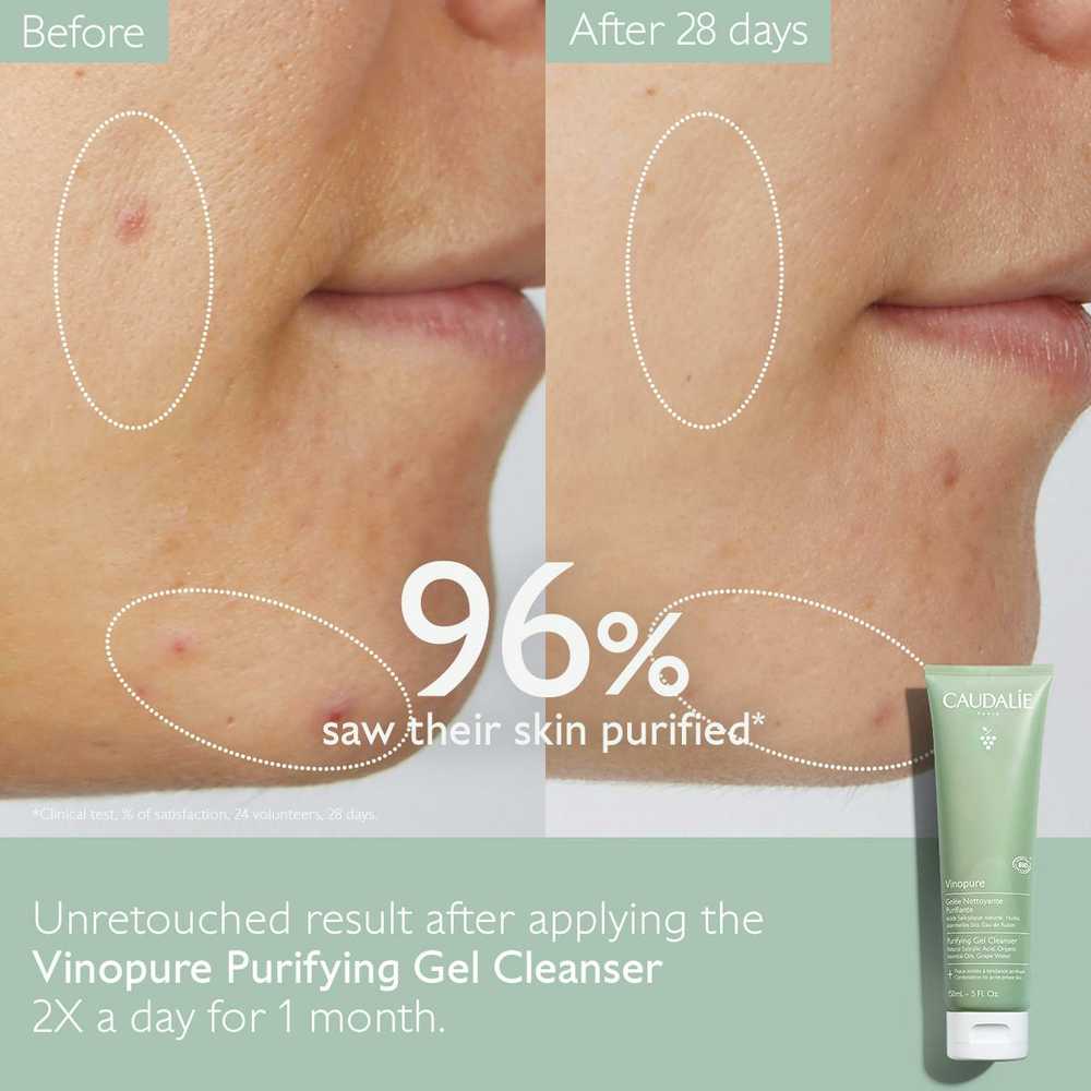 "Caudalie Vinopure" valomasis gelis 150ml