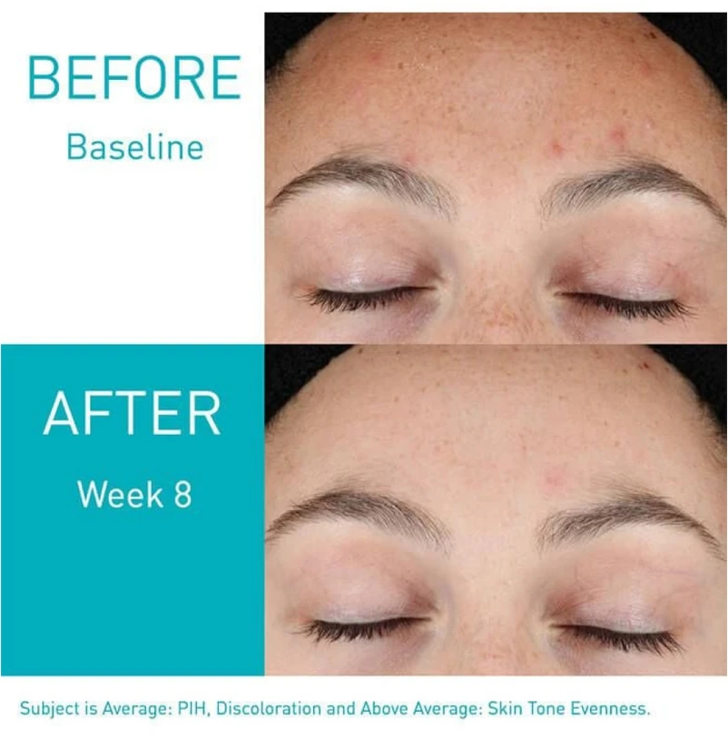 Regeneruojantis serumas veidui su retinoliu Cerave Blemish Resurfacing Retinol Sérum, 30 ml