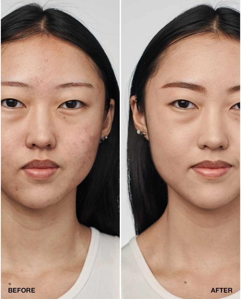 Clinique Even Better Clinical Serum Foundation SPF 20 makiažo pagrindas, atspalvis: CN28 Ivory, 30 ml