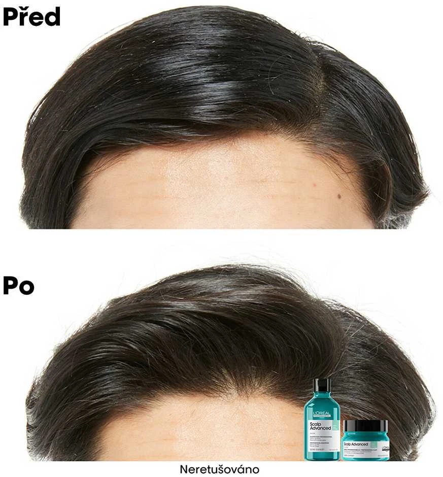 Valomoji kaukė - šampūnas riebiai galvos odai L'oreal Professionnel Scalp Advanced Anti-Oiliness 2-In-1 Deep Purifier Clay 250ml