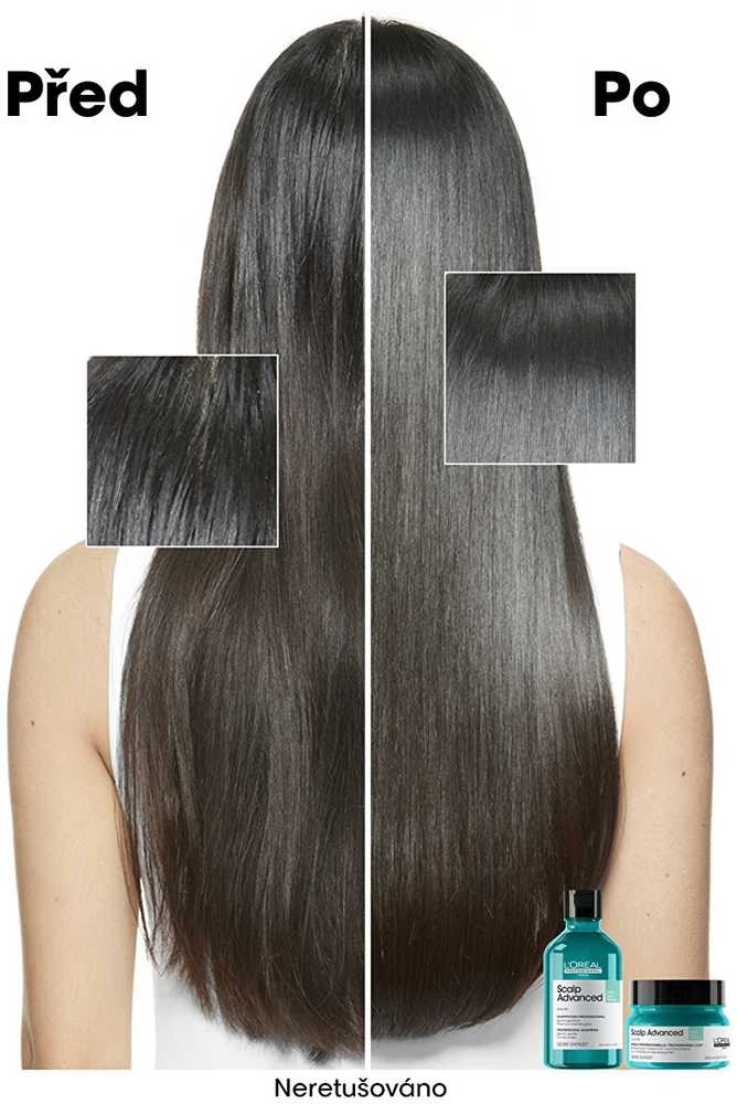 Valomoji kaukė - šampūnas riebiai galvos odai L'oreal Professionnel Scalp Advanced Anti-Oiliness 2-In-1 Deep Purifier Clay 250ml
