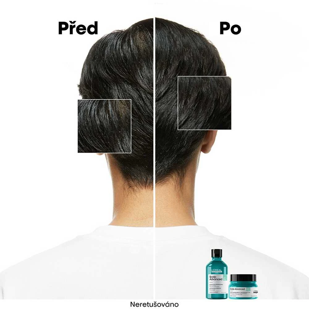 Valomoji kaukė - šampūnas riebiai galvos odai L'oreal Professionnel Scalp Advanced Anti-Oiliness 2-In-1 Deep Purifier Clay 250ml