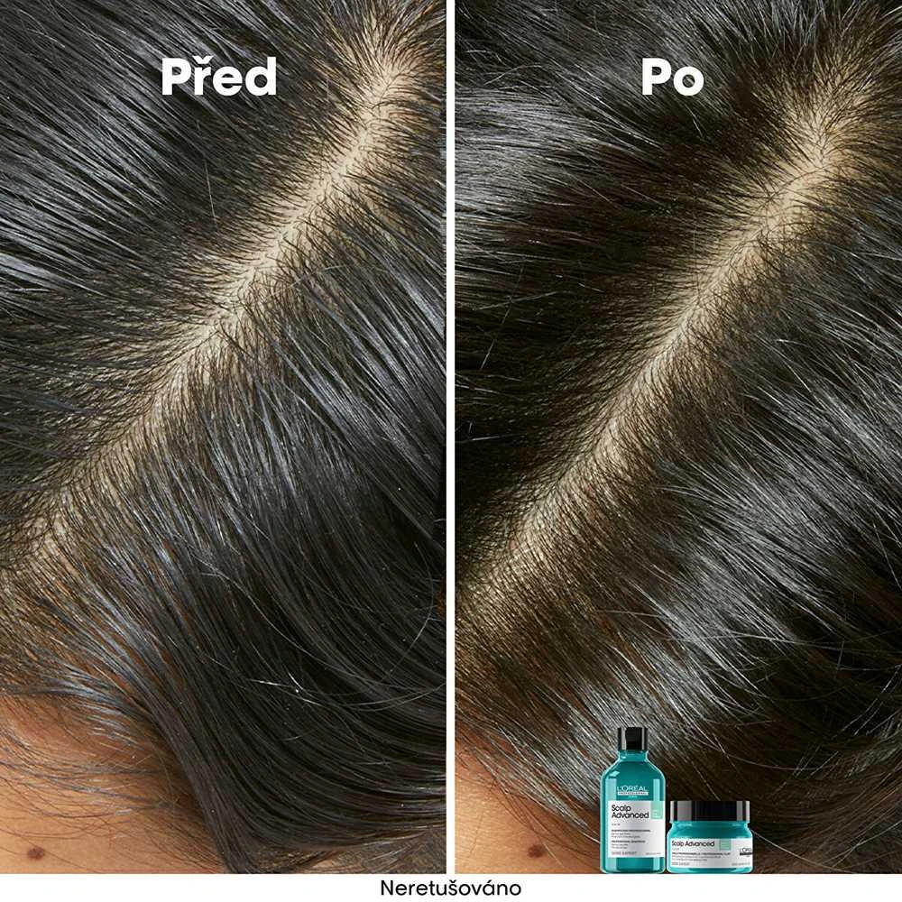 Valomoji kaukė - šampūnas riebiai galvos odai L'oreal Professionnel Scalp Advanced Anti-Oiliness 2-In-1 Deep Purifier Clay 250ml