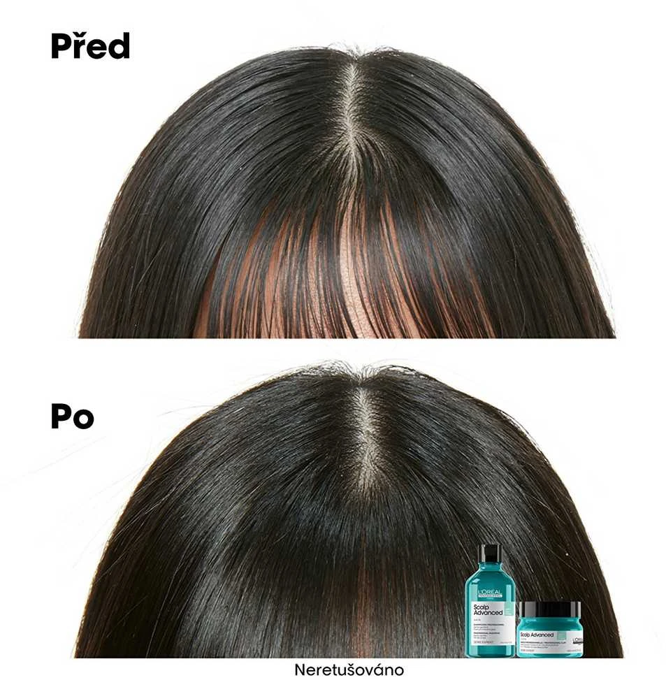Valomoji kaukė - šampūnas riebiai galvos odai L'oreal Professionnel Scalp Advanced Anti-Oiliness 2-In-1 Deep Purifier Clay 250ml