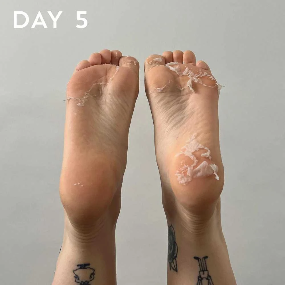 maskology FOOT PEEL Professional Foot Treatment nulupamoji pėdų kaukė-kojinės, 1 pora
