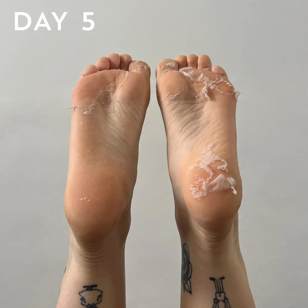 maskology FOOT PEEL Professional Foot Treatment nulupamoji pėdų kaukė-kojinės, 1 pora