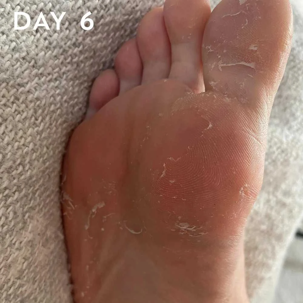 maskology FOOT PEEL Professional Foot Treatment nulupamoji pėdų kaukė-kojinės, 1 pora