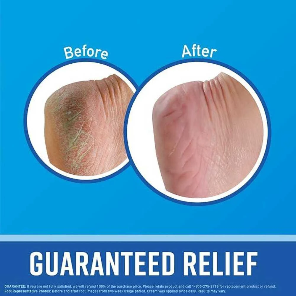 "O'keeffe's Healthy Feet" pėdų kremas 80ml
