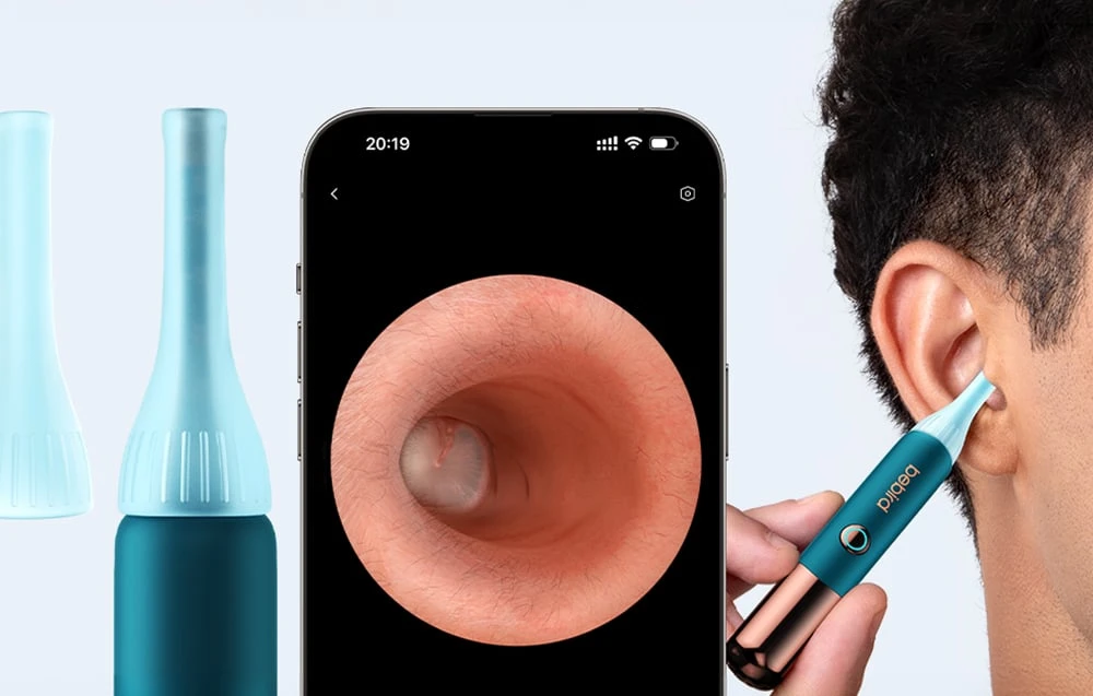 BEBIRD Earsight Ultra Camera Otoscope aprašymas - Prekės nuotrauka BEBIRD Earsight Ultra Camera Otoscope aprašymas - Prekės nuotrauka