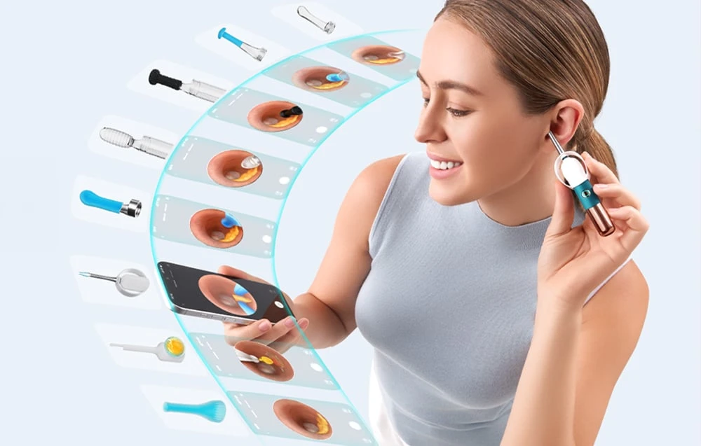 BEBIRD Earsight Ultra Camera Otoscope aprašymas - Prekės nuotrauka BEBIRD Earsight Ultra Camera Otoscope aprašymas - Prekės nuotrauka