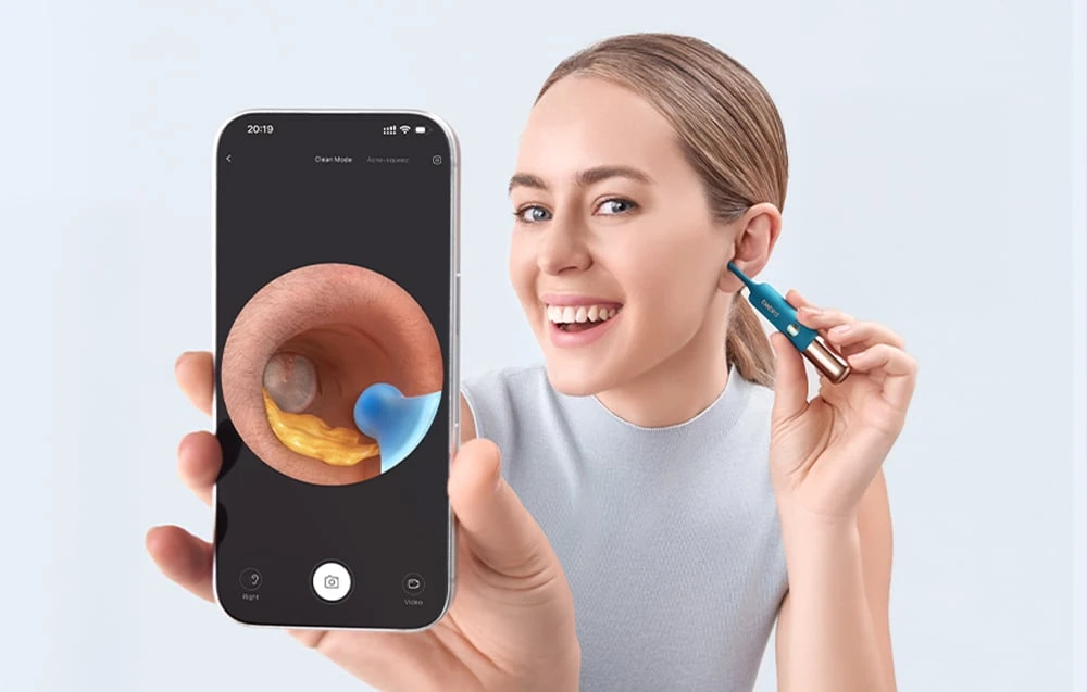 BEBIRD Earsight Ultra Camera Otoscope aprašymas - Prekės nuotrauka BEBIRD Earsight Ultra Camera Otoscope aprašymas - Prekės nuotrauka