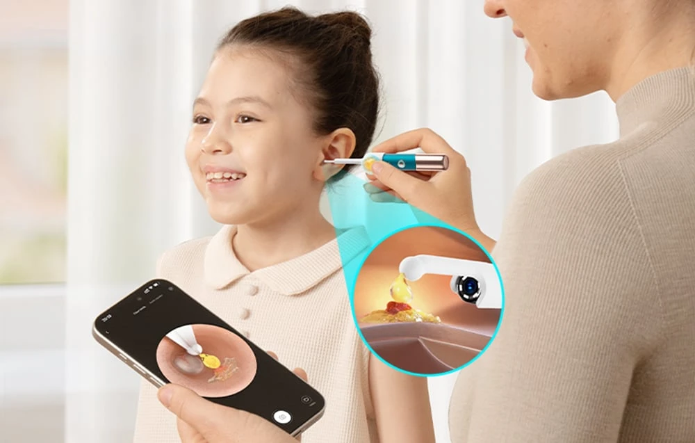 BEBIRD Earsight Ultra Camera Otoscope aprašymas - Prekės nuotrauka BEBIRD Earsight Ultra Camera Otoscope aprašymas - Prekės nuotrauka