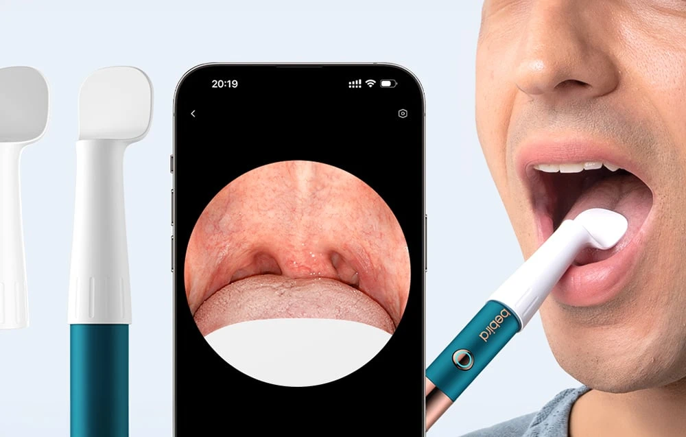 BEBIRD Earsight Ultra Camera Otoscope aprašymas - Prekės nuotrauka BEBIRD Earsight Ultra Camera Otoscope aprašymas - Prekės nuotrauka