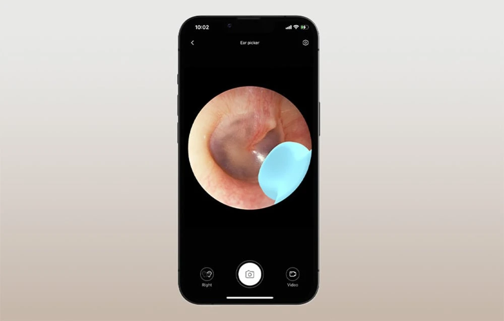 Smart Visual Ear-Clean Strypas Bebird M9 S (juodas) aprašymas - Prekės nuotrauka