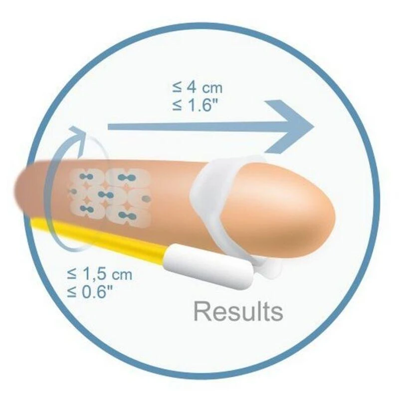 Andromedical Androextender