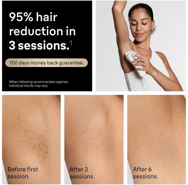 Braun IPL Silk·expert Pro 5 PL5412 IPL-laite