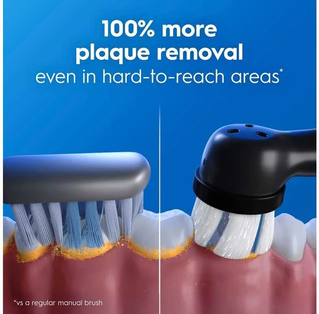 Dantų šepetėlio Oral-B iO efektyvumo palyginimas