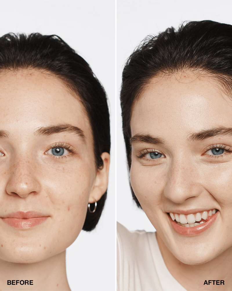 Odos atspalvį koreguojantis makiažo pagrindas Clinique Even Better™ Makeup su SPF15, 30 ml | spalva: CN 0.75 Custard
