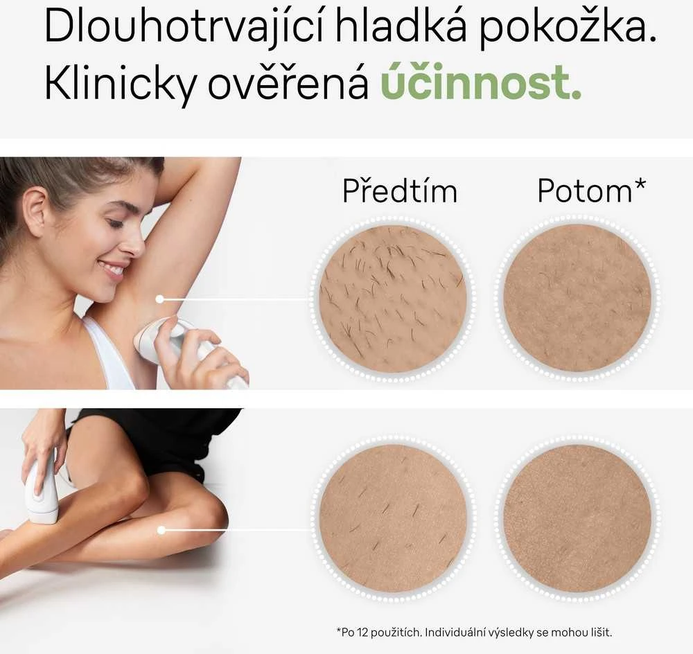 Braun Silk-expert Pro 3 IPL PL3020 balta ir-sidabrinė
