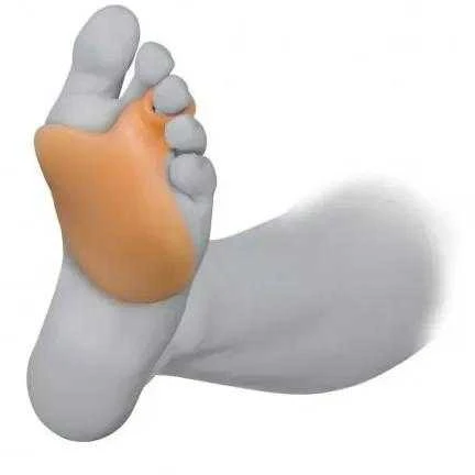 "Prim Comforsil Metatarsal Pad