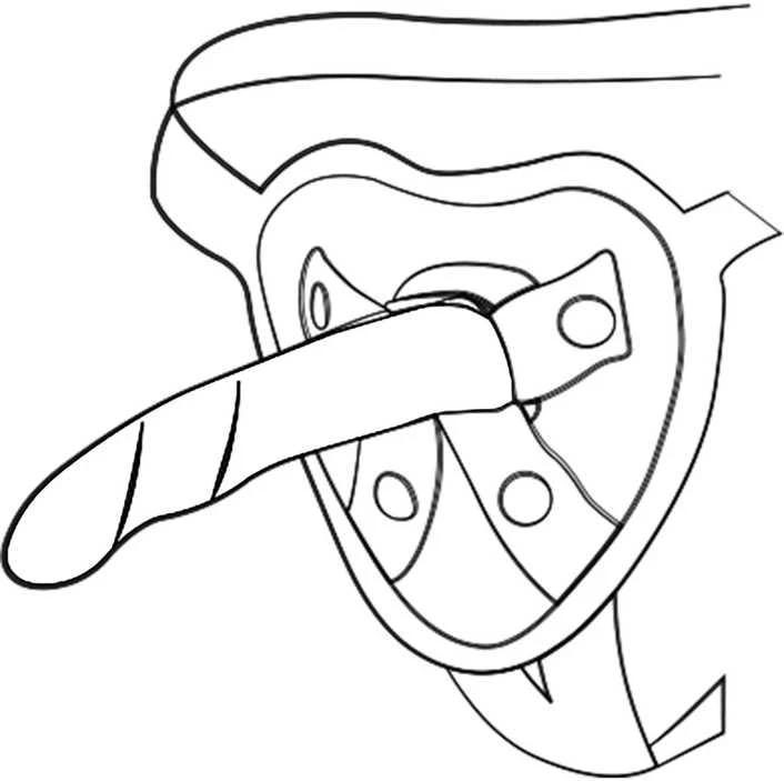 ROMP Piccolo Pegging Kit